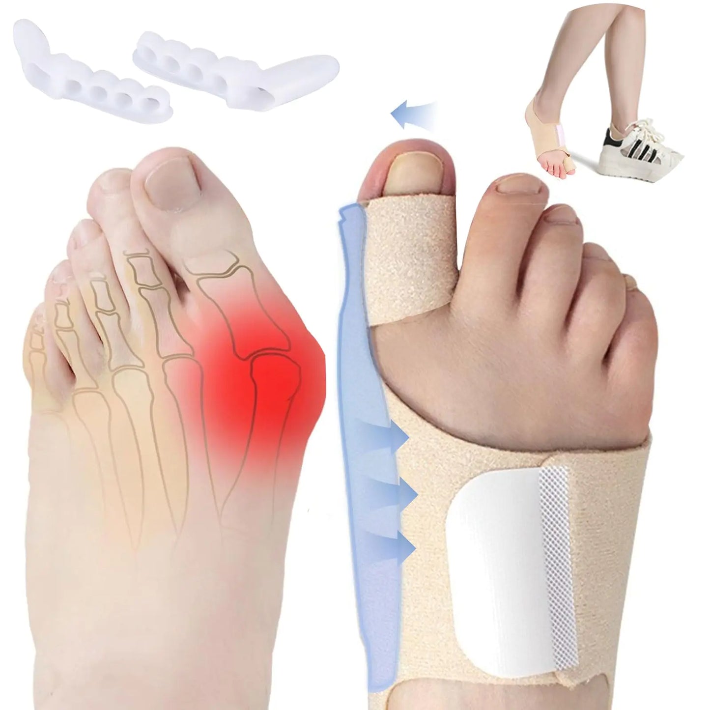 NOIBAD 4PCs Bunion Corrector for Women & Men Orthopedic Bunion Splint Big Toe Separator Pain Relief Non-Surgical Hallux Valgus Correction Adjustable Bunion Splint Day Night Support