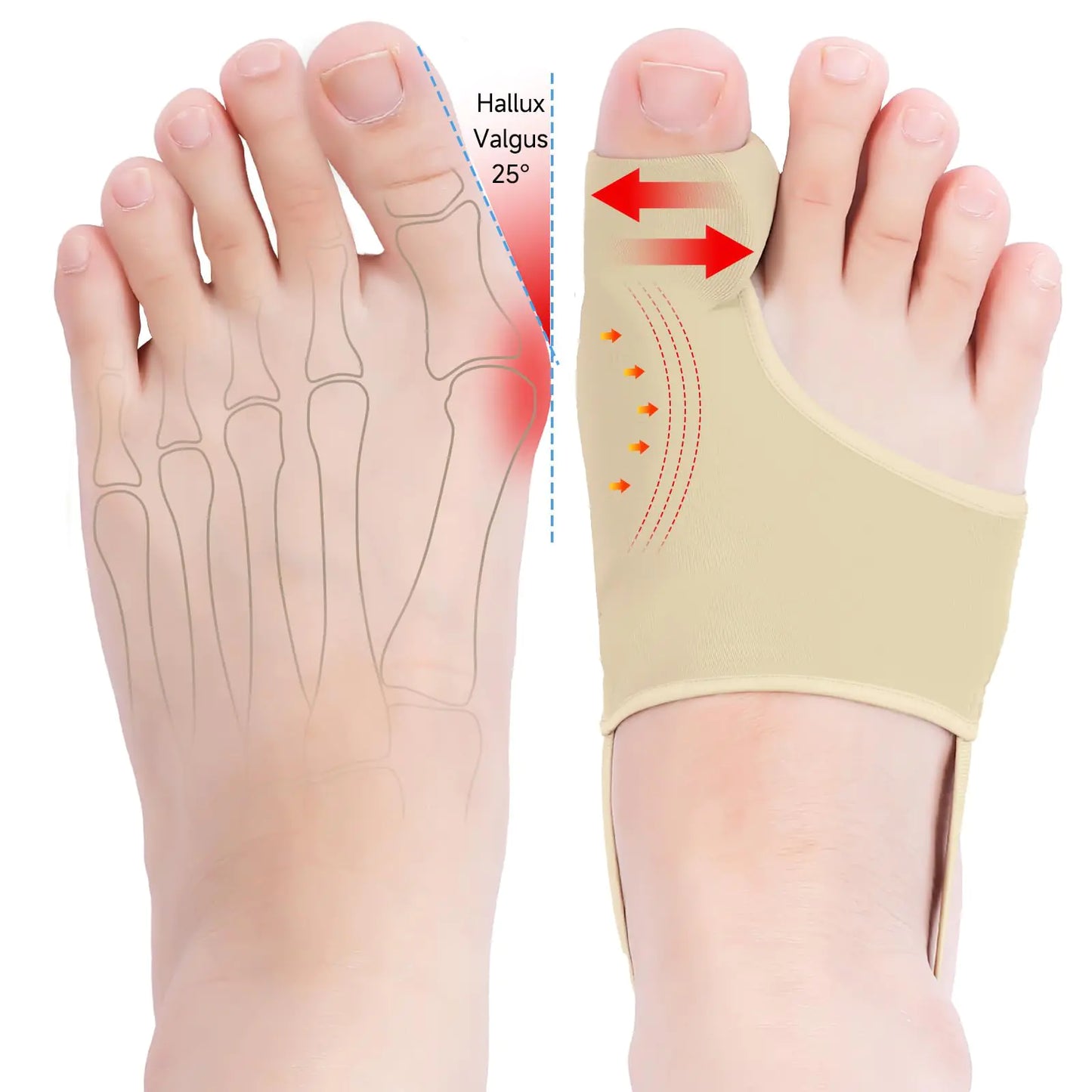 sundpik 2PCS Bunion Corrector for Women & Men Big Toe Big Toe Separator-Bunion Splint-Bunion Pads-Hammer Toe Straightener-Toe Spacers Pain Relief Comfortable & Breathable for Day/Night