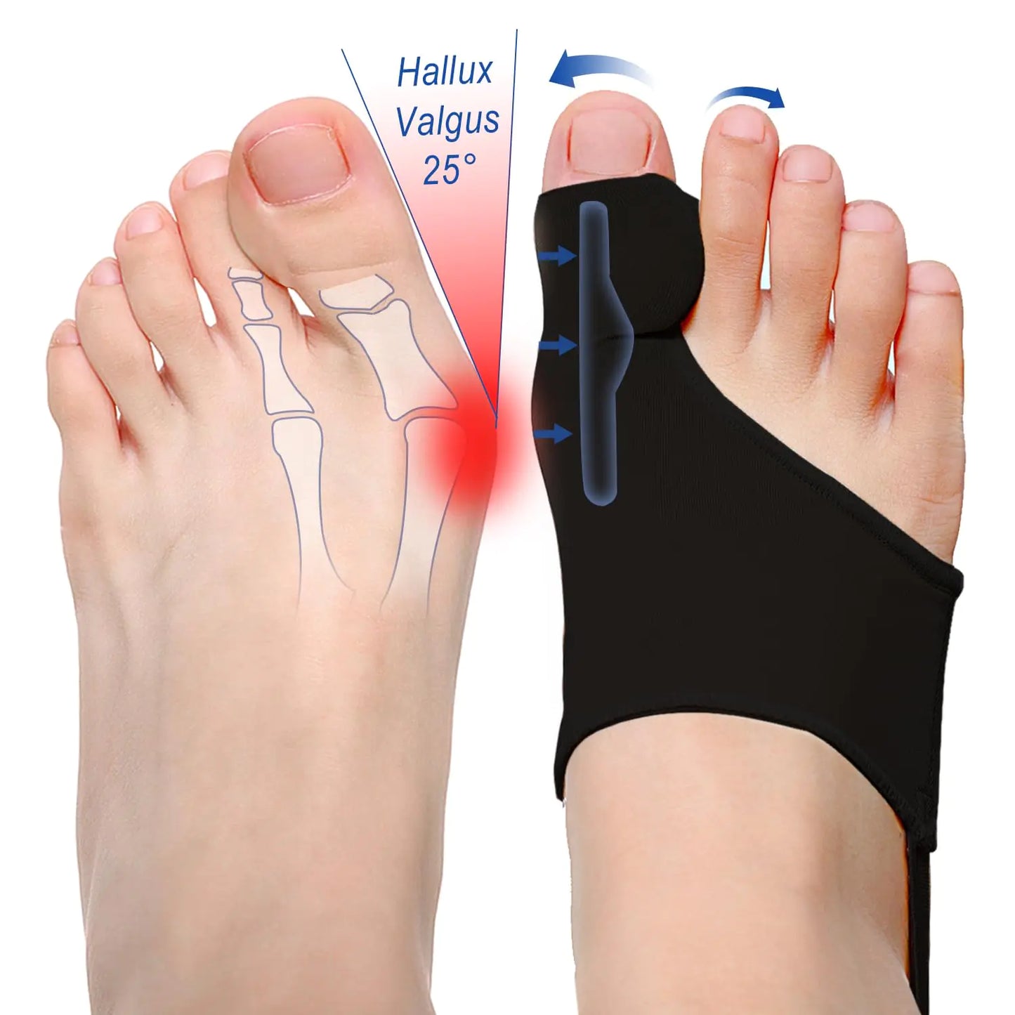ELFON Bunion Corrector for Women Men Big Toe Straightener 2 Pcs Bunion Splint for Men Bunion Toe Separator Gel Cushion Brace Protector Pain Relief Hallux Valgus Correction for Day and Night Black Large