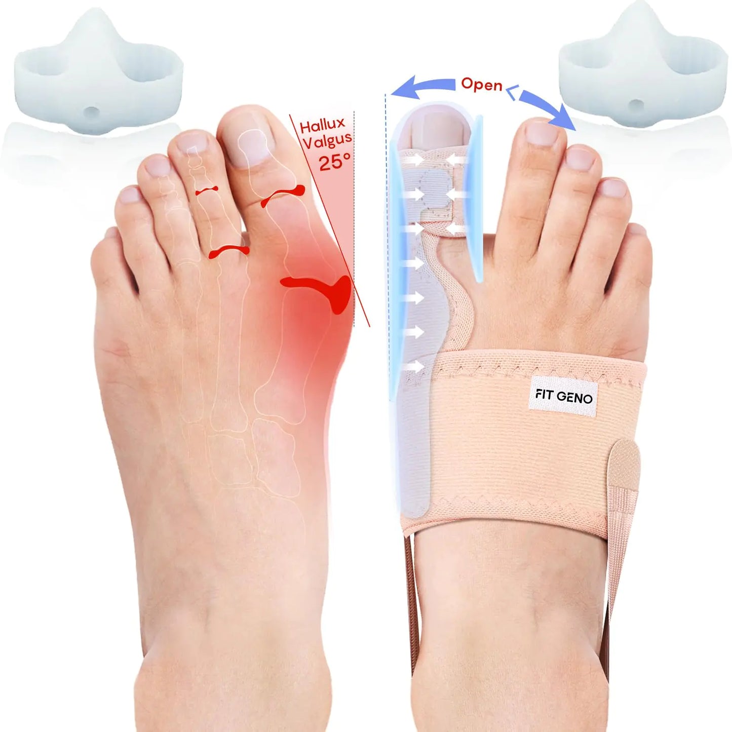 Fitgeno Bunion Corrector Women & Men Big Toe: Foot Straightener Splint Brace - Adjustable Bunyan Correction Orthopedic for Hallux Valgus Pain Relief (Beige 2pcs)